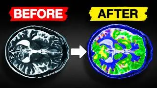 This Controversial Supplement Improves Brain Performance