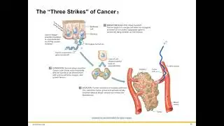 Cancer Genetics and Genomics, Part 2