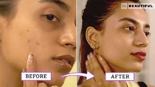 How To Improve Your Skin Texture | Skincare Tips For Bumpy Skin | Be Beautiful