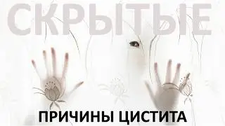Причины ЦИСТИТА. Жесткая ПРАВДА, о которой вам не говорят ВРАЧИ! Обзор международного протокола.