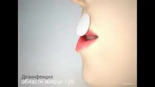 Контурная пластика губ (Демо процедуры)