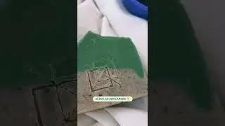 Sağlıklı Cilt İçin Defne ve Çörek Otu Yağı Seti: Egzama Etkilerini Azaltan Muhteşem Çözüm!