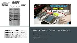 Micro Chapter 9 Part 2 Gel Electrophoresis