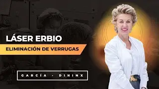 Eliminación de verrugas con Láser Erbio | Dra. Garcia-Dihinx