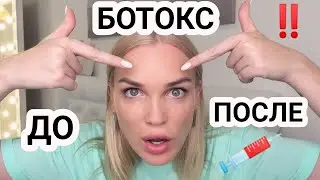 ❌НЕ КОЛИТЕ БОТОКС❌ПОКА НЕ ПОСМОТРИТЕ ЭТО ВИДЕО️✅ДО/ ПОСЛЕ 