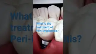 What is the treatment of Peri-implantitis?