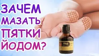 Для чего и как мазать пятки йодом? Йодная сетка: от чего помогает, правила нанесения