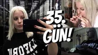 1 Aylık Tüp Mideli Olarak Bir Günüm😐| Beslenme, Dans, Sohbet · #VLOG