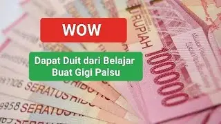 Dapat Duit dari Buat Gigi Palsu Pertama kali