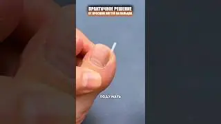 Корректор для вросшего ногтя