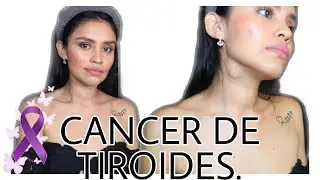 CÓMO SUPE QUE TENGO CANCER DE TIROIDES🦋