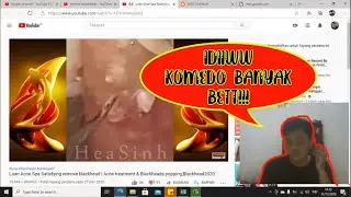 Blackhead Whitehead remove satisfying [Reaction] jerawat batu