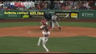 Scary Tanner Houck injury! 