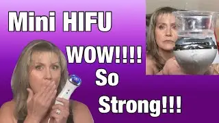 NON-Surgical Facelift | MINI HIFU | High Intensity Focused Ultrasound Before & After | 5 Week Update