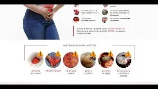 LILUAMA: Precio en pero