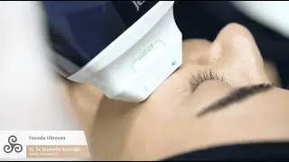 Ameliyatsız Yüz Germe Ultracel - Uzm. Dr. Şerafettin Saraçoğlu
