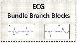 Bundle Branch Block | ECG | Right Bundle Branch Block | Left Bundle Branch Block | Explained