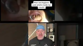 Medicinal Mouth Maggots?! 😱 