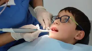How To Strengthen Children's Teeth