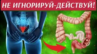 ТИХИЕ СИМПТОМЫ РАКА КИШЕЧНИКА ,НЕ ИГНОРИРУЙ ЭТО!