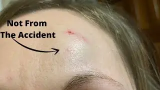 I WAS IN A CAR ACCIDENT