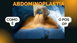 COMO É o pós operatório da abdominoplastia