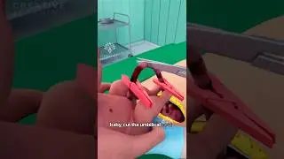 What Really Happens During a C-Section 
