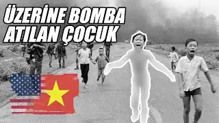 Üzerine Bomba Düşen Küçük Kız Çocuğunun Hikayesi (Vietnamlı Kim Phuc)