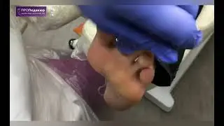 Педикюр пилкой