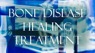 All Bone Disease Healing Treatment 🌛⭐🌜