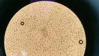 (pus) cell under microscope
