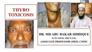 Hyperthyroidism /Thyrotoxicosis  Overview: cause, clinical features, investigations and management
