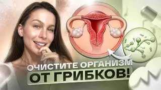 Молочница и цистит. Кандида и паразитоз. Как избавиться от грибка?