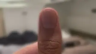 literal thumbnail