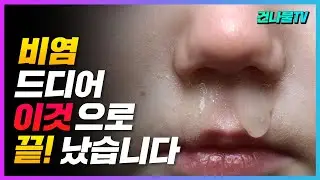 해결되지 않는 비염, 확실하게 해결하는 방법