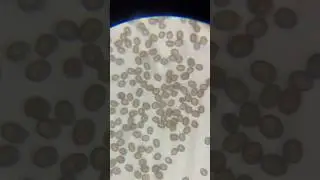 Looking at Mushroom Spores Under a Microscope 