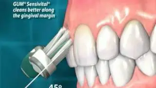 GUM SensiVital