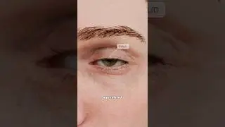 What is eyelid ptosis and why does it happen? Explained in 3D
