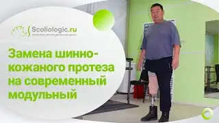 Протез бедра модульный. Замена шинно-кожаного протеза на современный модульный.
