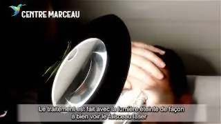 Epilation laser sourcils - Centre Marceau Paris
