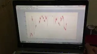 Visualizing EMG Signals in Real-Time: MATLAB and Arduino Tutorial