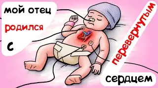 Мой отец родился с перевернутым сердцем
