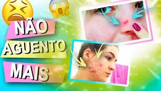 TERCEIRO MÊS | O PIOR MÊS!! O ROACUTAN está ACABANDO COMIGO 😭