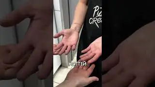 Why do some people at Dodo wear gloves while others don't? 