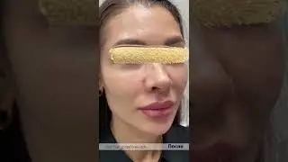 Гармонизация лица
