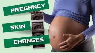 Get Ready for the CRAZY Changes of PREGNANCY! #pregnancychanges #pregnancyskin #firsttrimister