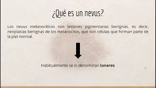 Nevus o lunares: información para el público en general