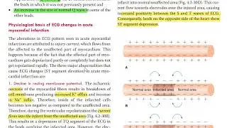 ecg 4