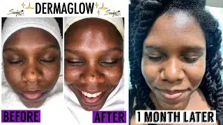 MY FIRST DERMAPLANING EXPERIENCE! | Full Facial | VLOG #2 | Atkins Twins