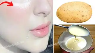 Apply To The Skin At Night Wake Up Without Wrinkles In The Morning!! - Home Remedies
